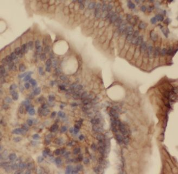 ALKBH1 Rabbit Polyclonal Antibody