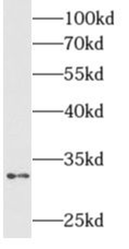 ALKBH4 Rabbit Polyclonal Antibody