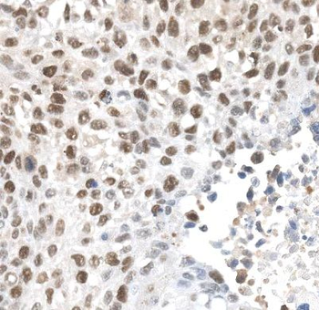 ALKBH5 Rabbit Polyclonal Antibody