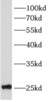ALKBH7 Rabbit Polyclonal Antibody
