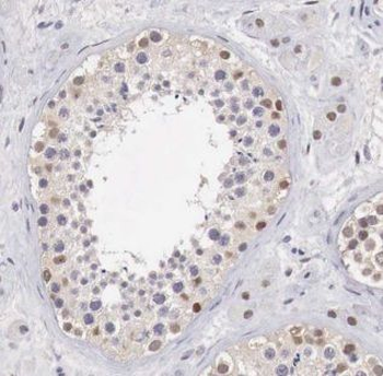 ALKBH7 Rabbit Polyclonal Antibody