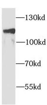 AP2A1 Rabbit Polyclonal Antibody