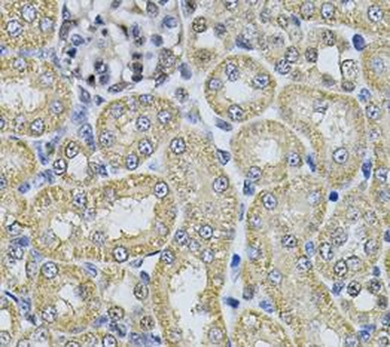 AP2A1 Rabbit Polyclonal Antibody