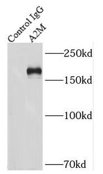 A2M Rabbit Polyclonal Antibody