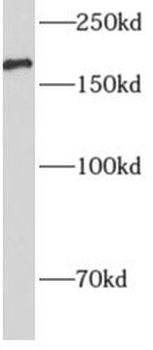 A2M Rabbit Polyclonal Antibody