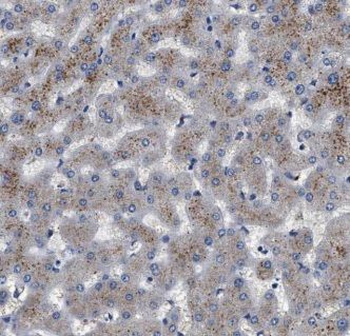 A2M Rabbit Polyclonal Antibody
