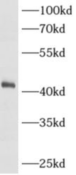 AMACR Rabbit Polyclonal Antibody
