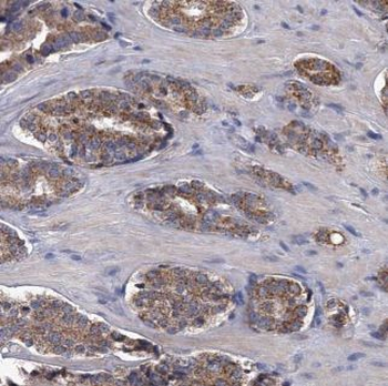 AMACR Rabbit Polyclonal Antibody