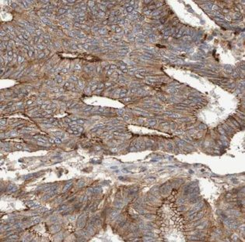 AMD1 Rabbit Polyclonal Antibody