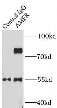 AMFR Rabbit Polyclonal Antibody