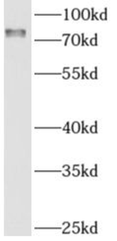 AMFR Rabbit Polyclonal Antibody