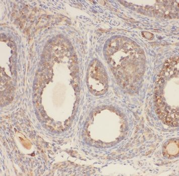 AMFR Rabbit Polyclonal Antibody