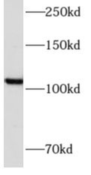AMOTL1 Rabbit Polyclonal Antibody