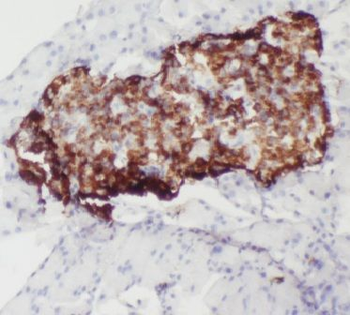 IAPP Rabbit Polyclonal Antibody