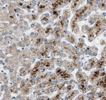 ANG Rabbit Polyclonal Antibody