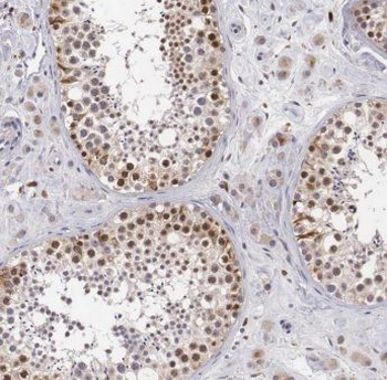 ANKRD54 Rabbit Polyclonal Antibody