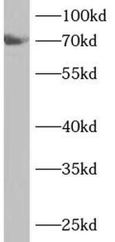 ANKS1B Rabbit Polyclonal Antibody
