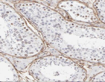 ANKS1B Rabbit Polyclonal Antibody