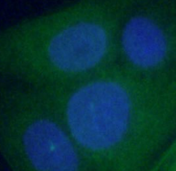 ANXA1 Antibody