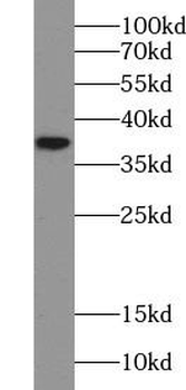 ANXA10 Rabbit Polyclonal Antibody