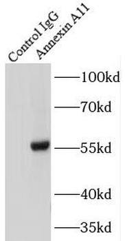 ANXA11 Rabbit Polyclonal Antibody