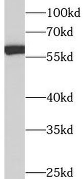 ANXA11 Rabbit Polyclonal Antibody