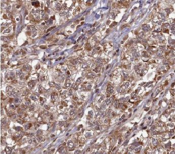 ANXA11 Rabbit Polyclonal Antibody