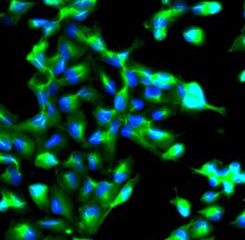 ANXA2 Rabbit Polyclonal Antibody