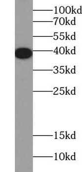 ANXA2 Rabbit Polyclonal Antibody