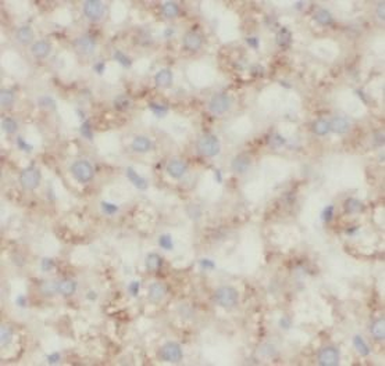 ANXA2 Rabbit Polyclonal Antibody