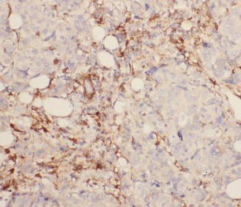 ANXA2 Mouse Monoclonal Antibody