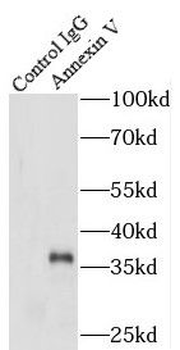ANXA5 Antibody