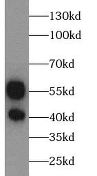 ANXA7 Rabbit Polyclonal Antibody