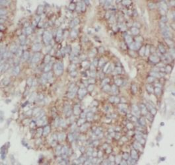 ANXA7 Rabbit Polyclonal Antibody