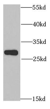 ANP32A Antibody