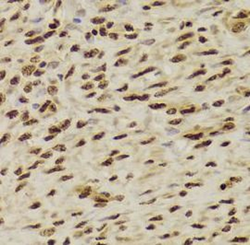 ANP32A Antibody