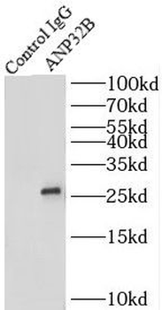 ANP32B Antibody