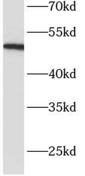 SERPINC1 Rabbit Polyclonal Antibody