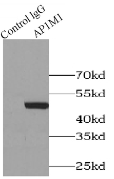 AP1M1 Rabbit Polyclonal Antibody