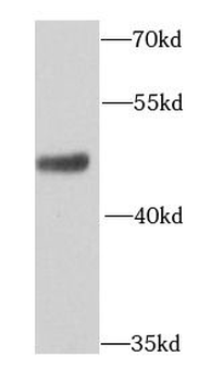 AP1M2 Rabbit Polyclonal Antibody