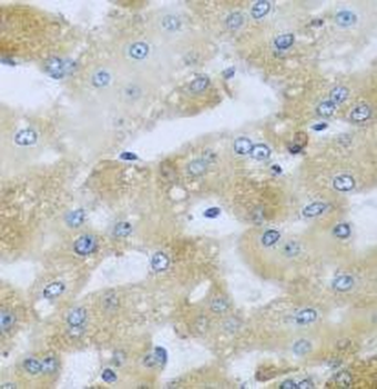 AP1M2 Rabbit Polyclonal Antibody