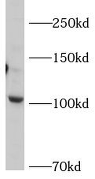 AP2A2 Rabbit Polyclonal Antibody