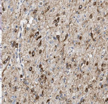 ANAPC2 Rabbit Polyclonal Antibody