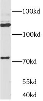 APLP2 Rabbit Polyclonal Antibody