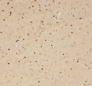 APLP2 Rabbit Polyclonal Antibody