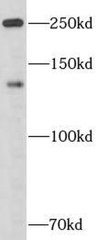 APOB Rabbit Polyclonal Antibody
