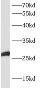 APOBEC2 Rabbit Polyclonal Antibody