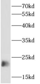 APOBEC3C Rabbit Polyclonal Antibody