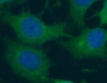 APOBEC3G Rabbit Polyclonal Antibody