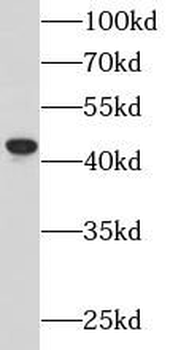 APOBEC3G Rabbit Polyclonal Antibody